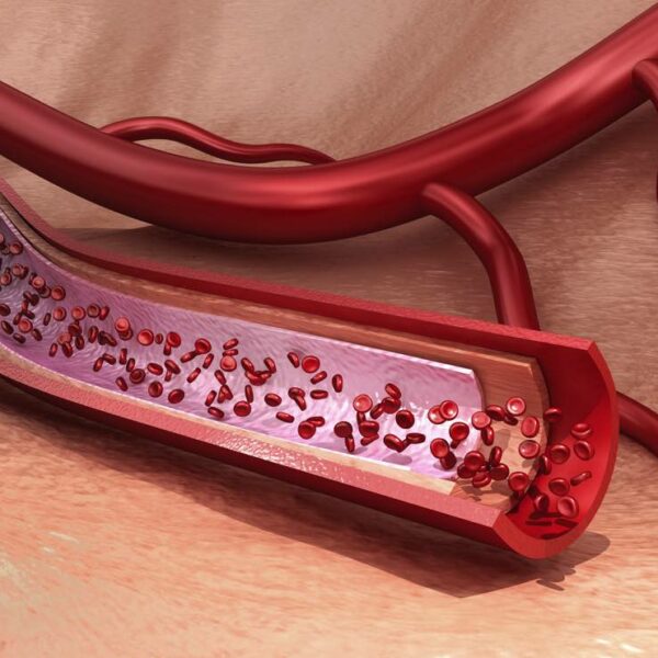 Minoxidil-whatis Minoxidil-whatis