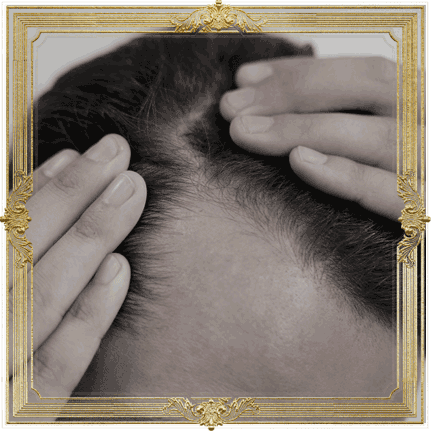 RG-hair-growth-fl RG-hair-髮再生