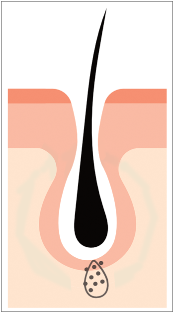 hairlosslaw_growth_p2-s hairlosslaw_growth_p2-s