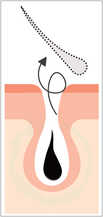 hairlosslaw_growth_p4-s hairlosslaw_growth_p4-s