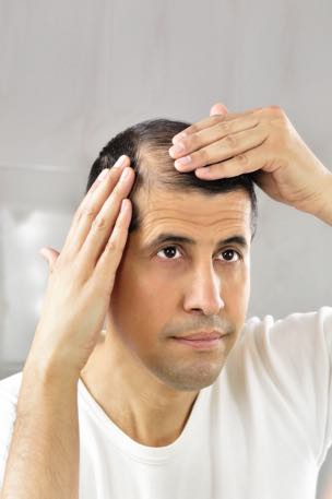 hp-hairloss-man hairloss-脫髮-雄性