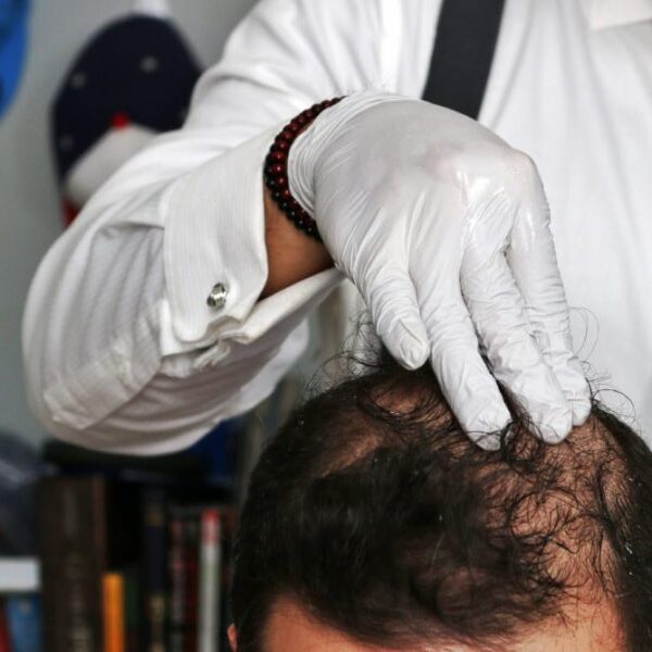 hairlosslaw_consulting2