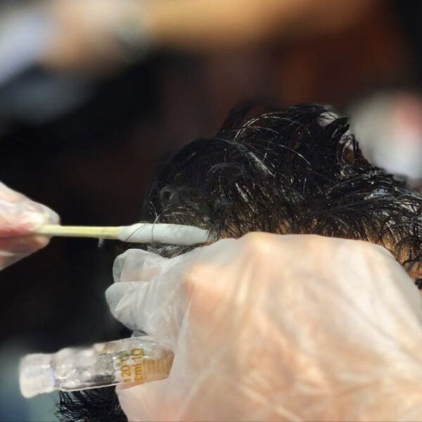 hp_hairlosslaw_solution2 hairloss-solution-防脫-生髮水