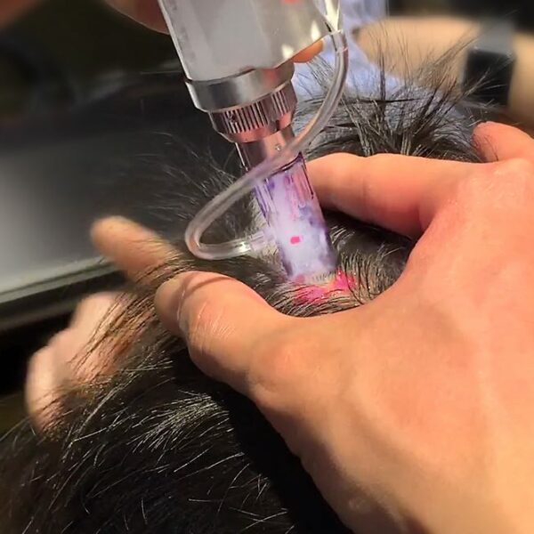 hairlosslaw_therapy